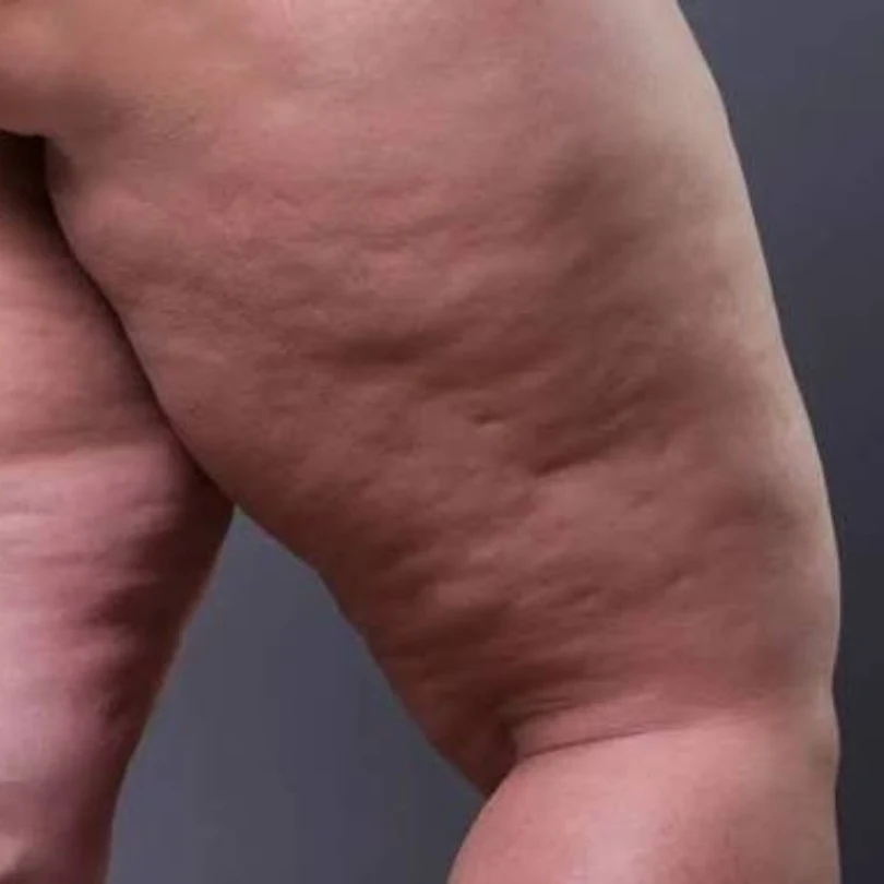 Pernas