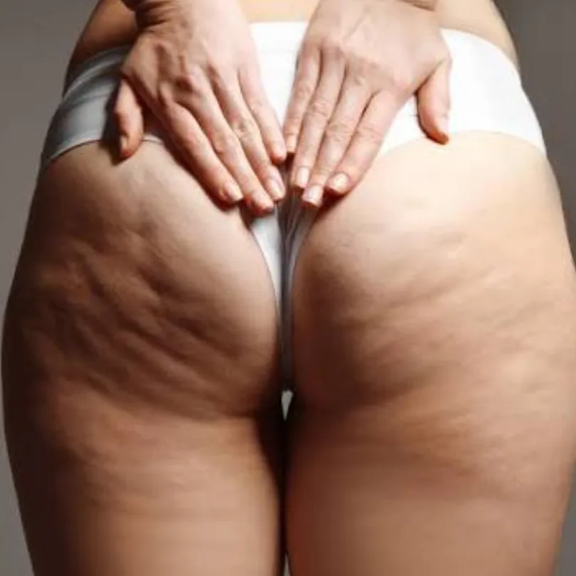 Bumbum