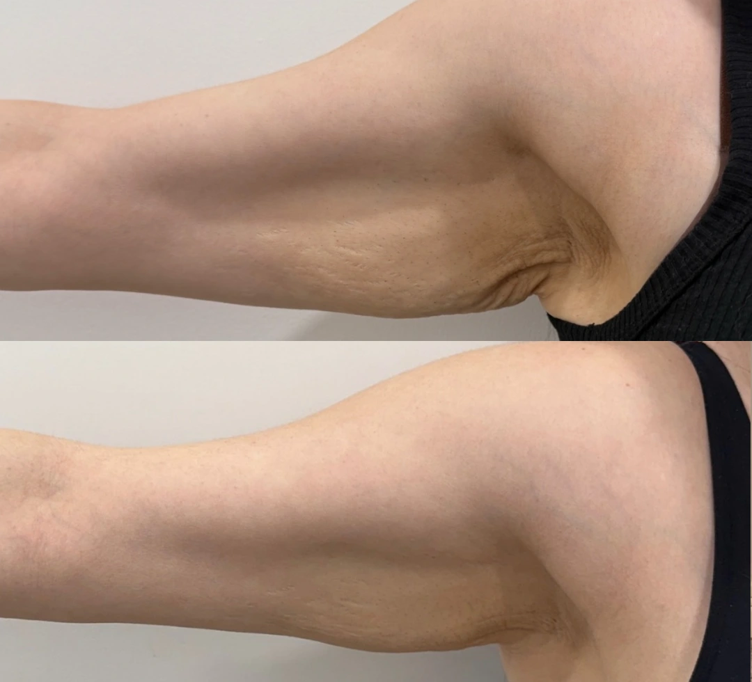 Avaliação de cliente CelluLipo