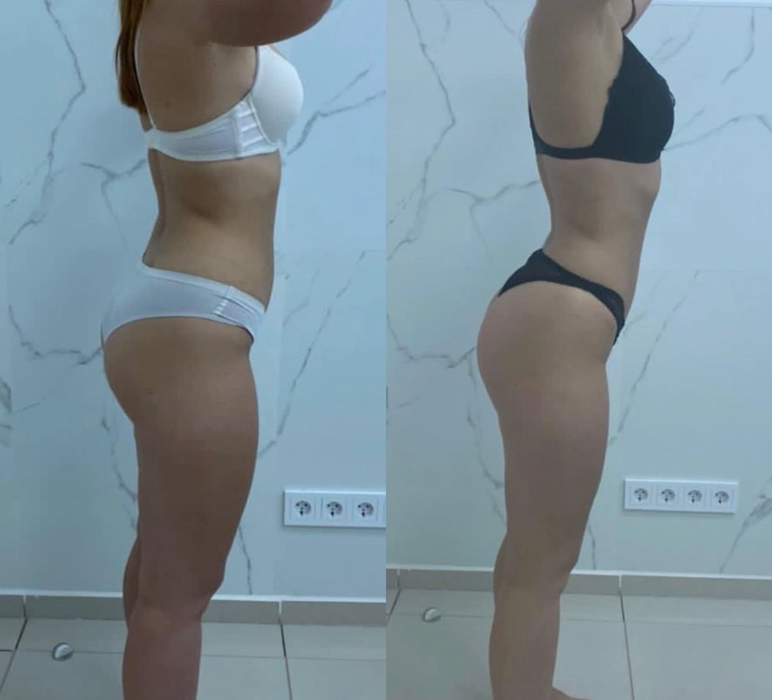 Avaliação de cliente CelluLipo